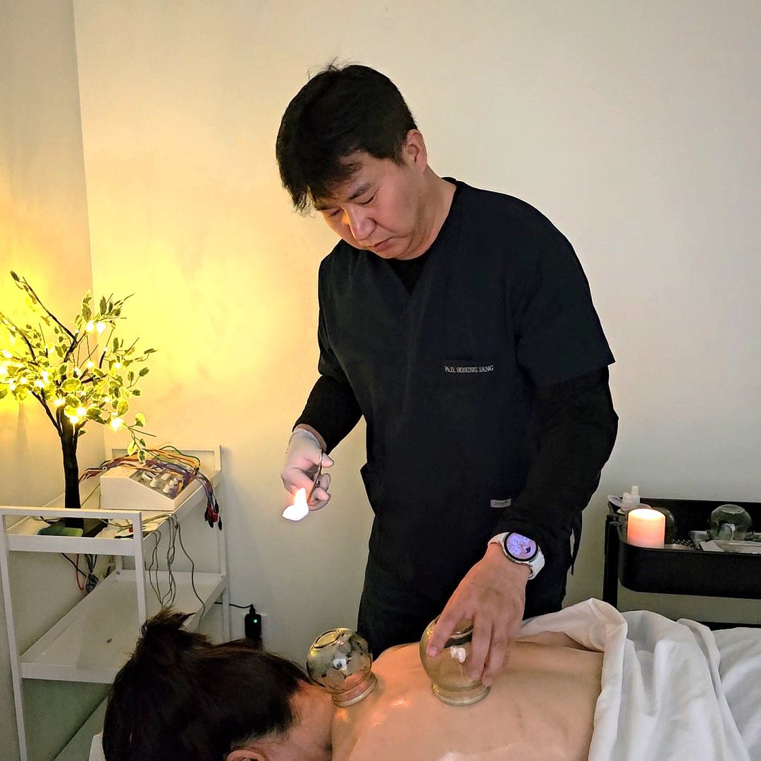 Cupping treatment in session